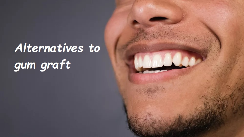 Alternatives to gum graft