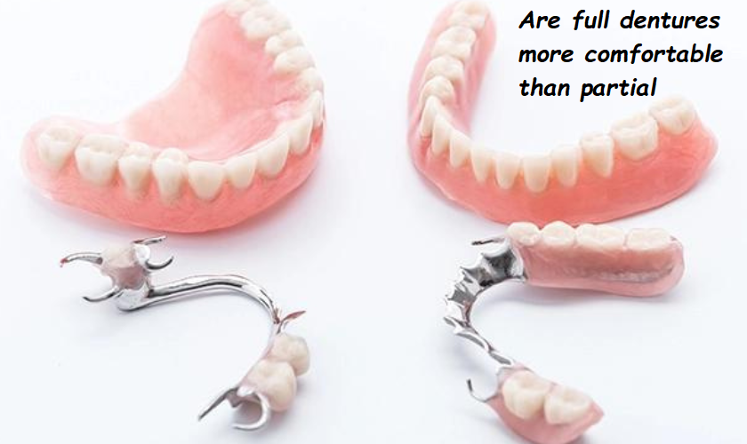 Are full dentures more comfortable than partial