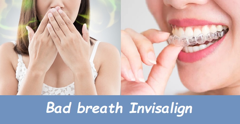 Bad breath invisalign