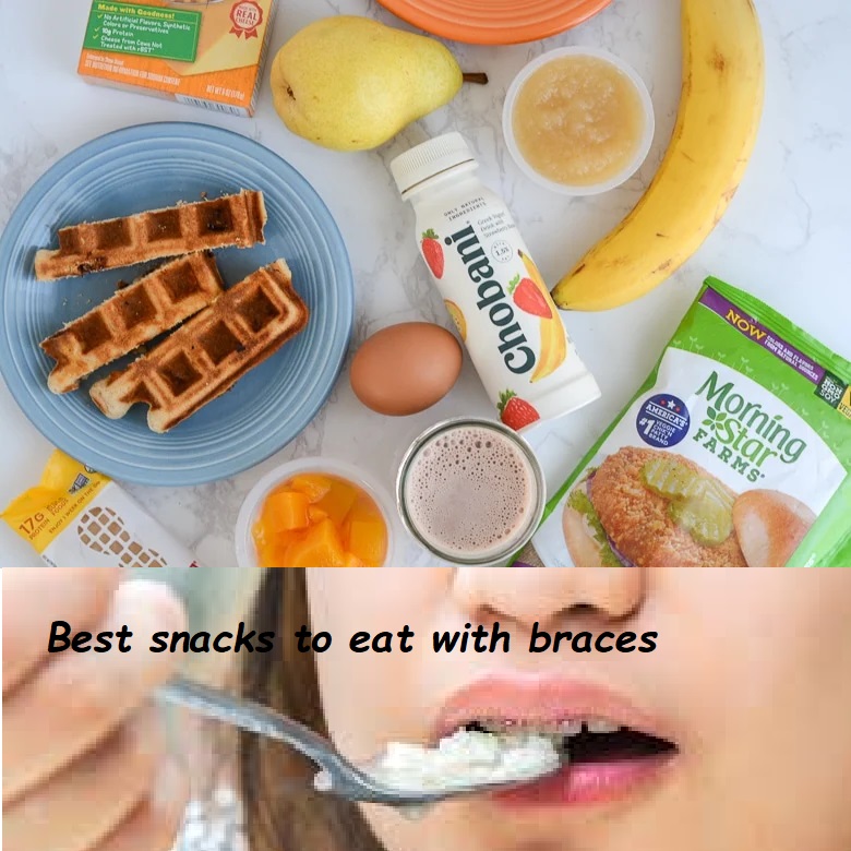 Best snacks to eat with braces