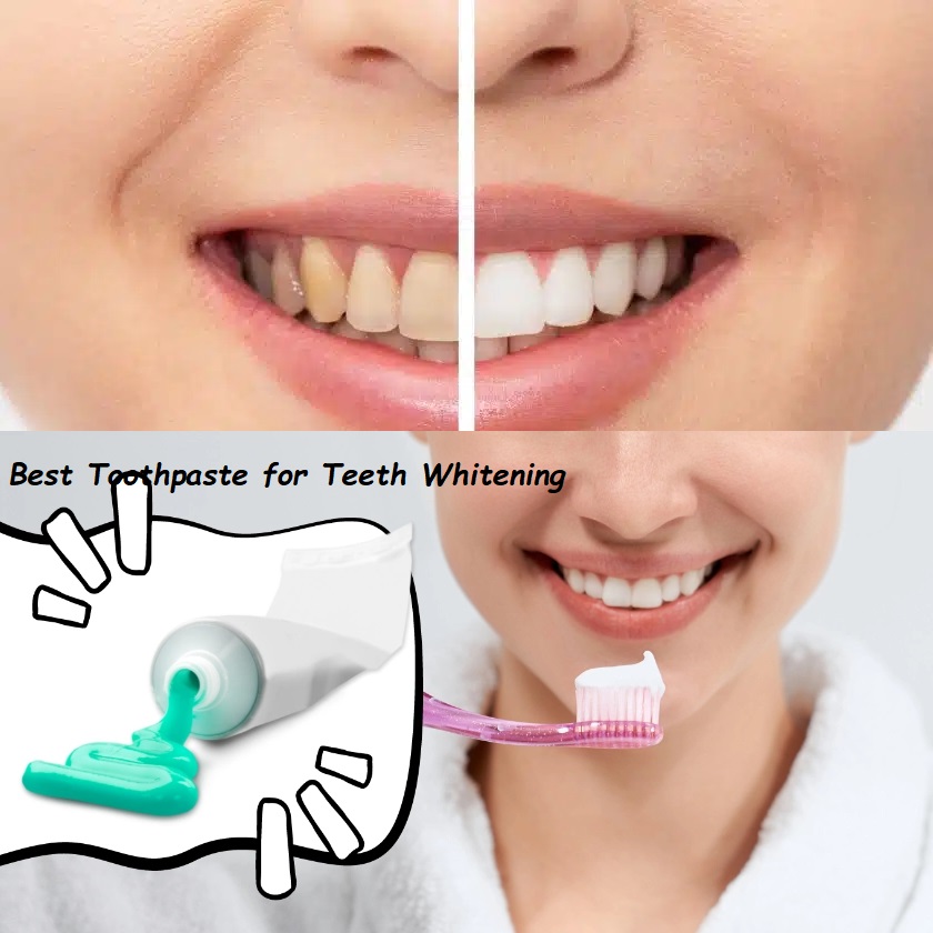 best toothpaste for teeth whitening