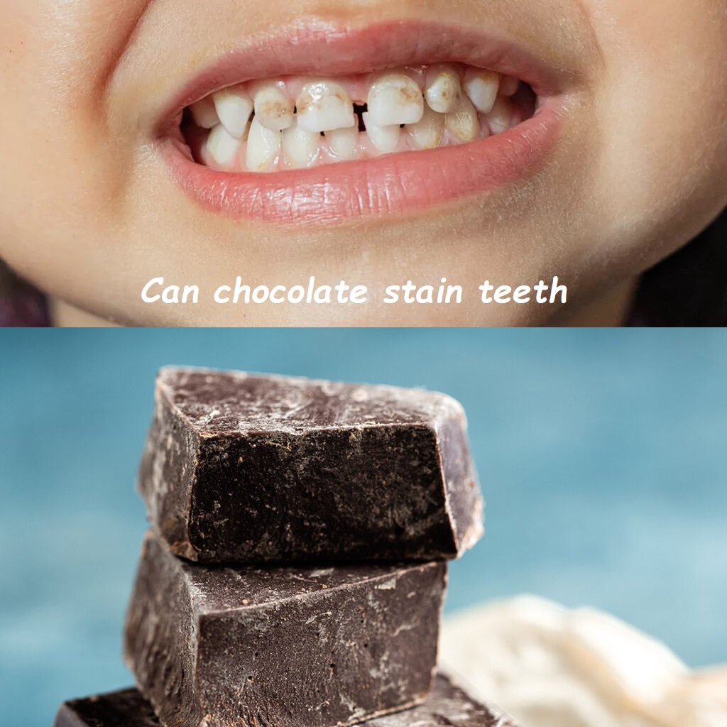 Can chocolate stain teeth