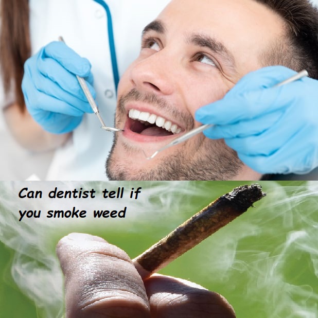 Can dentist tell if you smoke weed