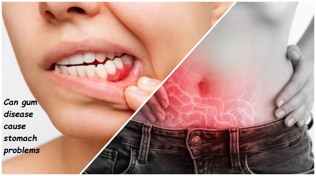 Can gum disease cause stomach problems