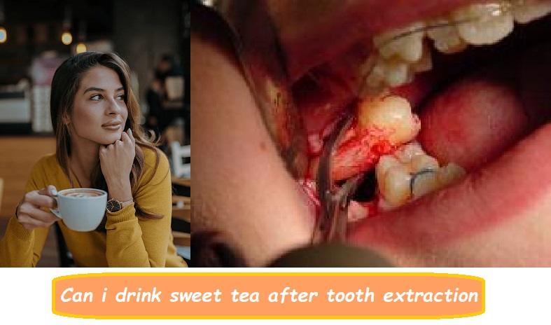 Can i drink sweet tea after tooth extraction