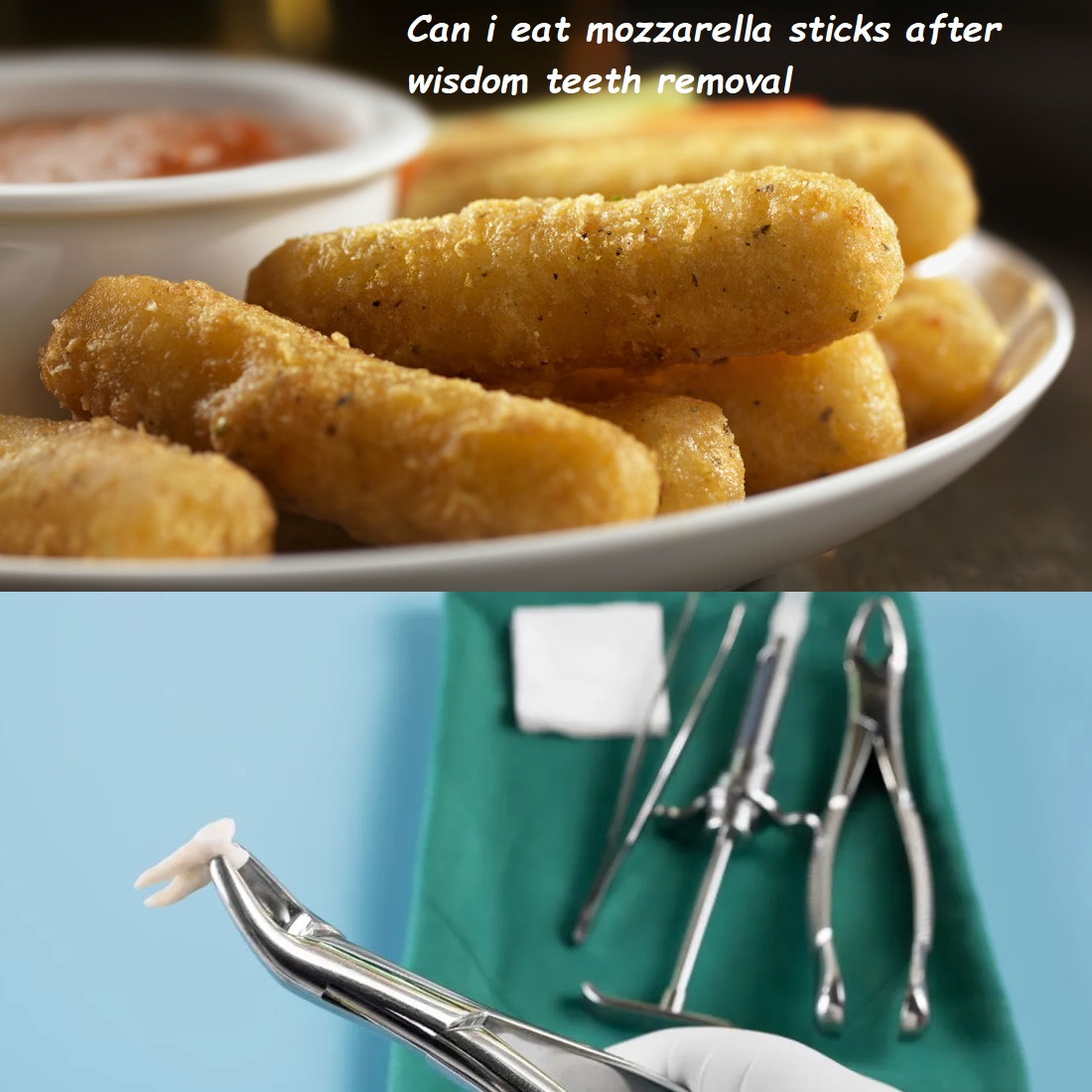 Can i eat mozzarella sticks after wisdom teeth removal