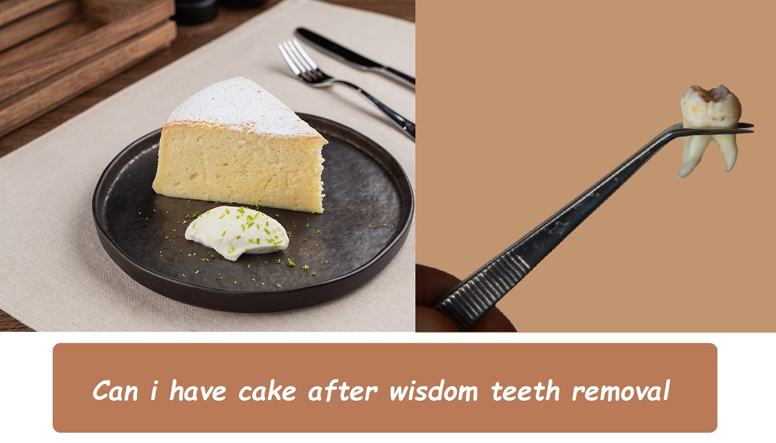 Can i have cake after wisdom teeth removal