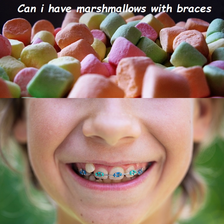 Can i have marshmallows with braces