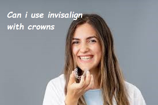 Can i use invisalign with crowns