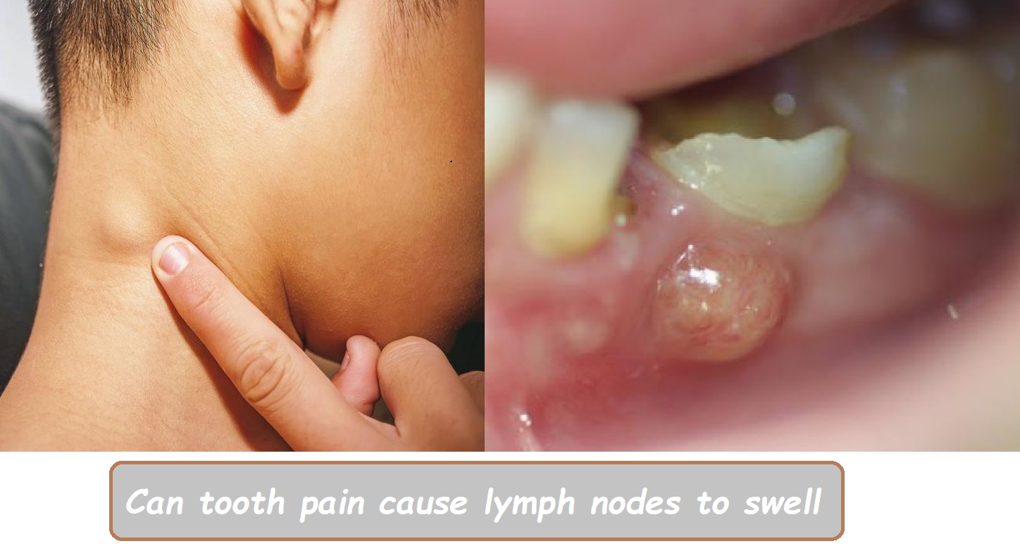 Can tooth pain cause lymph nodes to swell