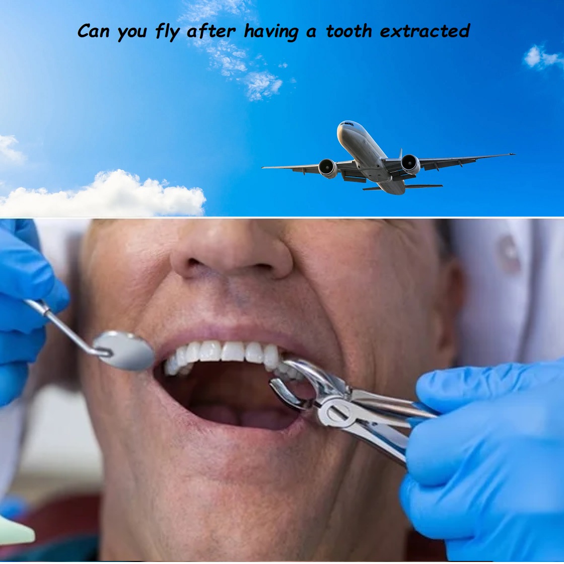 Can you fly after having a tooth extracted