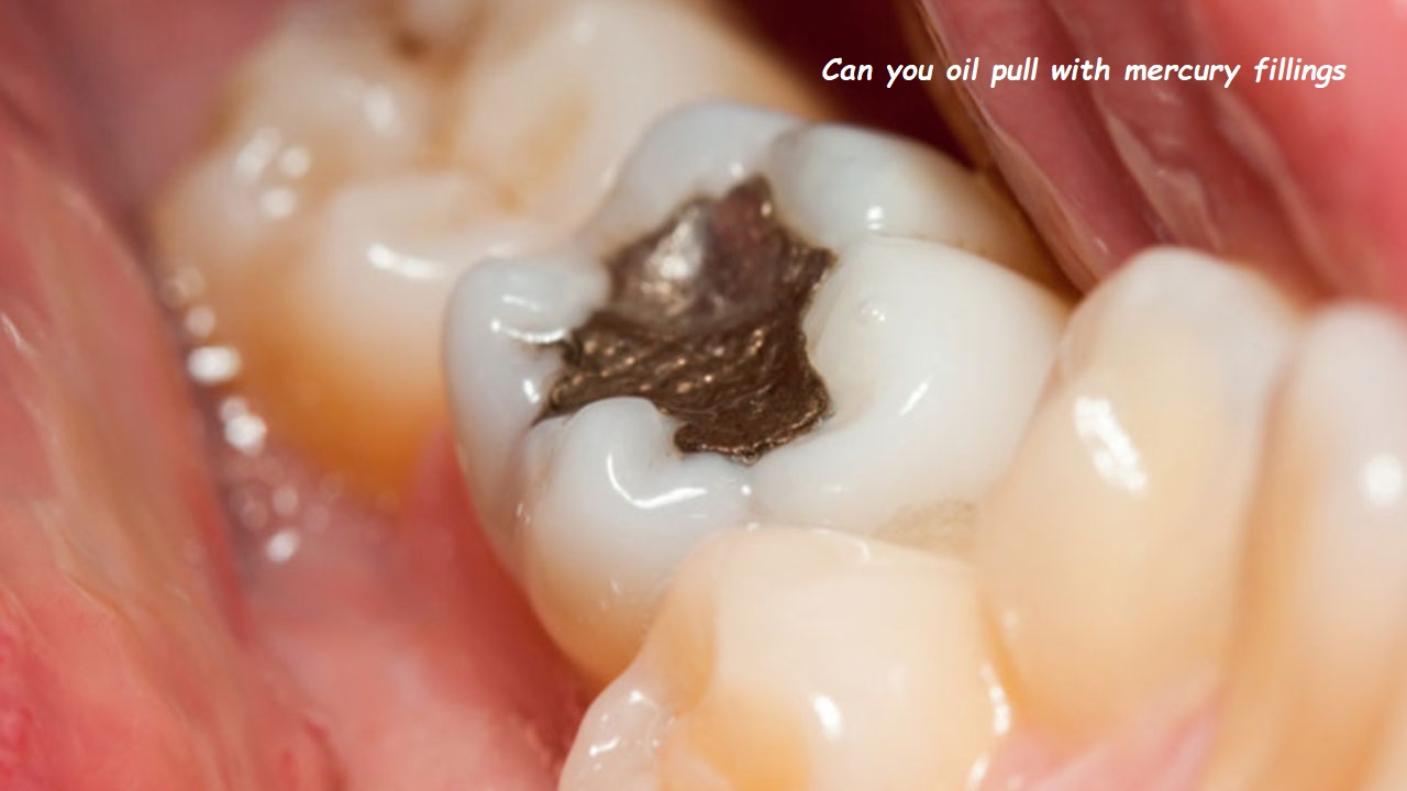 Can you oil pull with mercury fillings