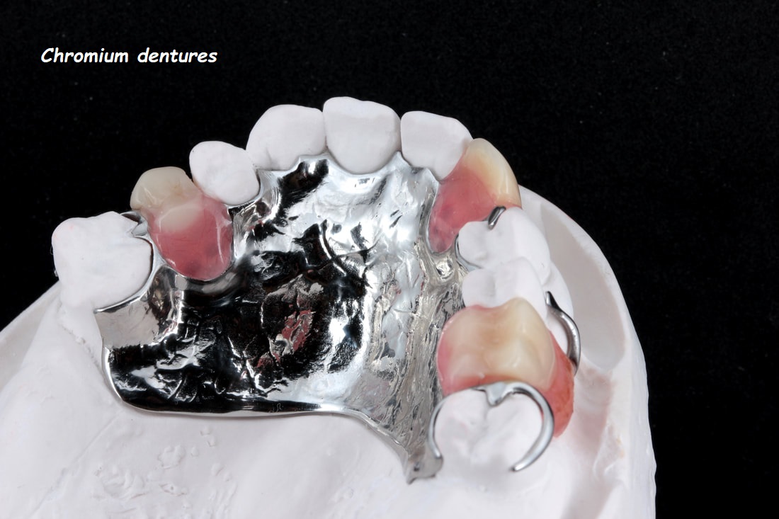 Chromium dentures