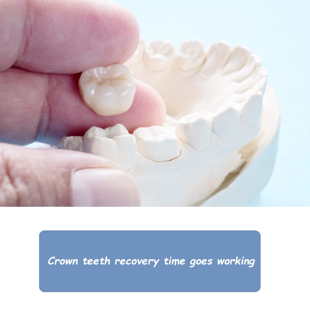 Crown teeth recovery time goes working