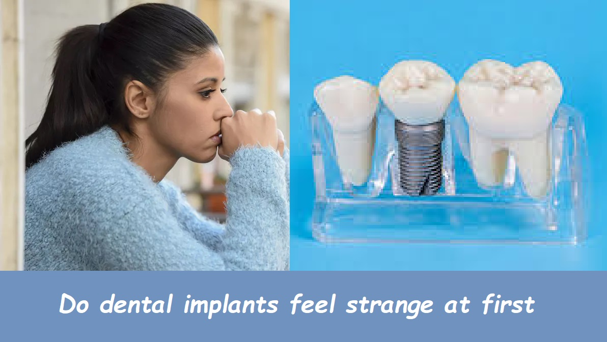 Do dental implants feel strange at first