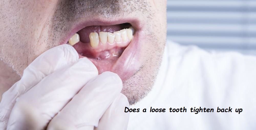 Does a loose tooth tighten back up