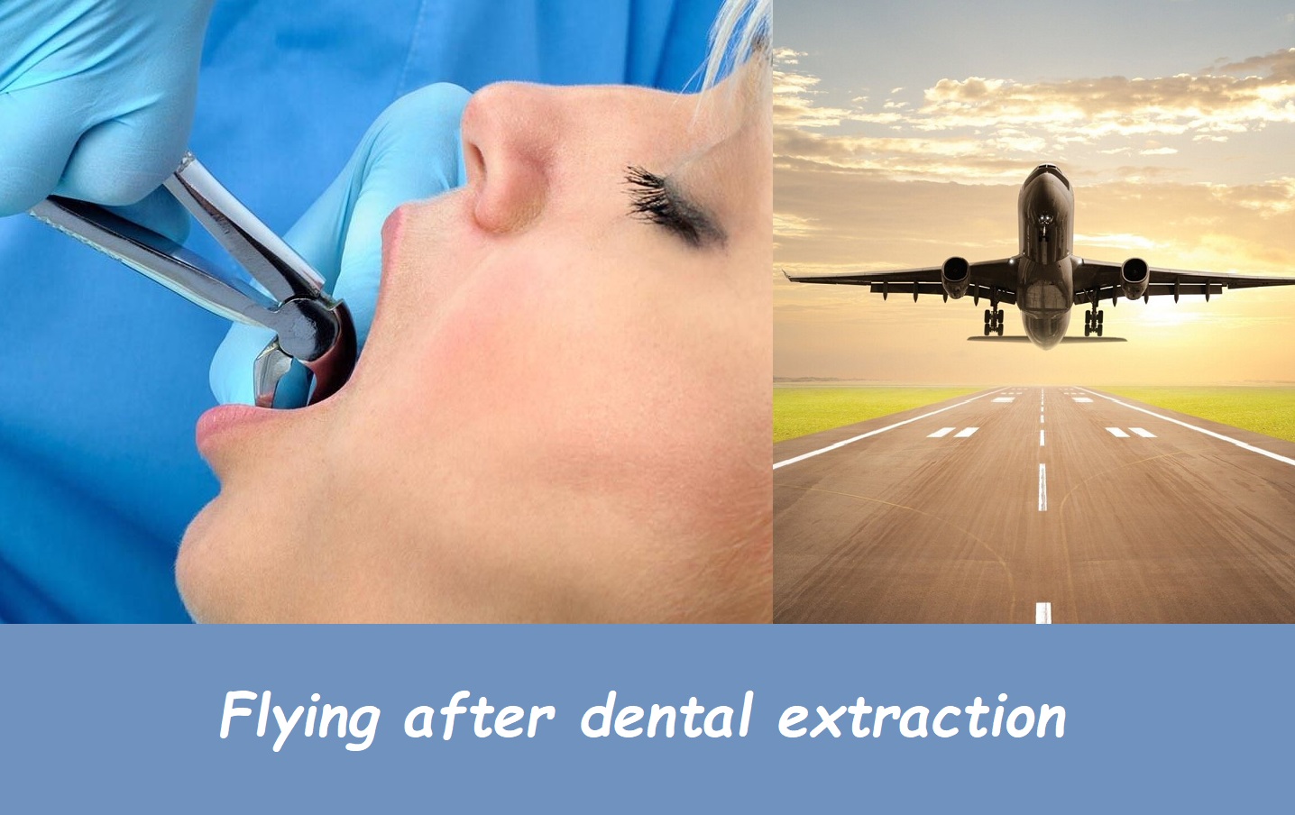 Flying after dental extraction