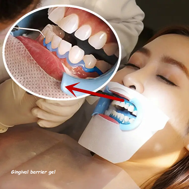 Gingival barrier gel