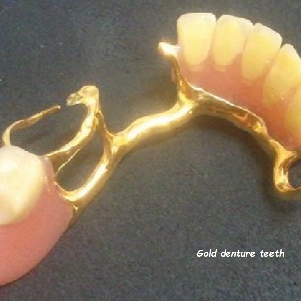 gold denture teeth