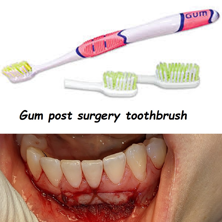 Gum post surgery toothbrush