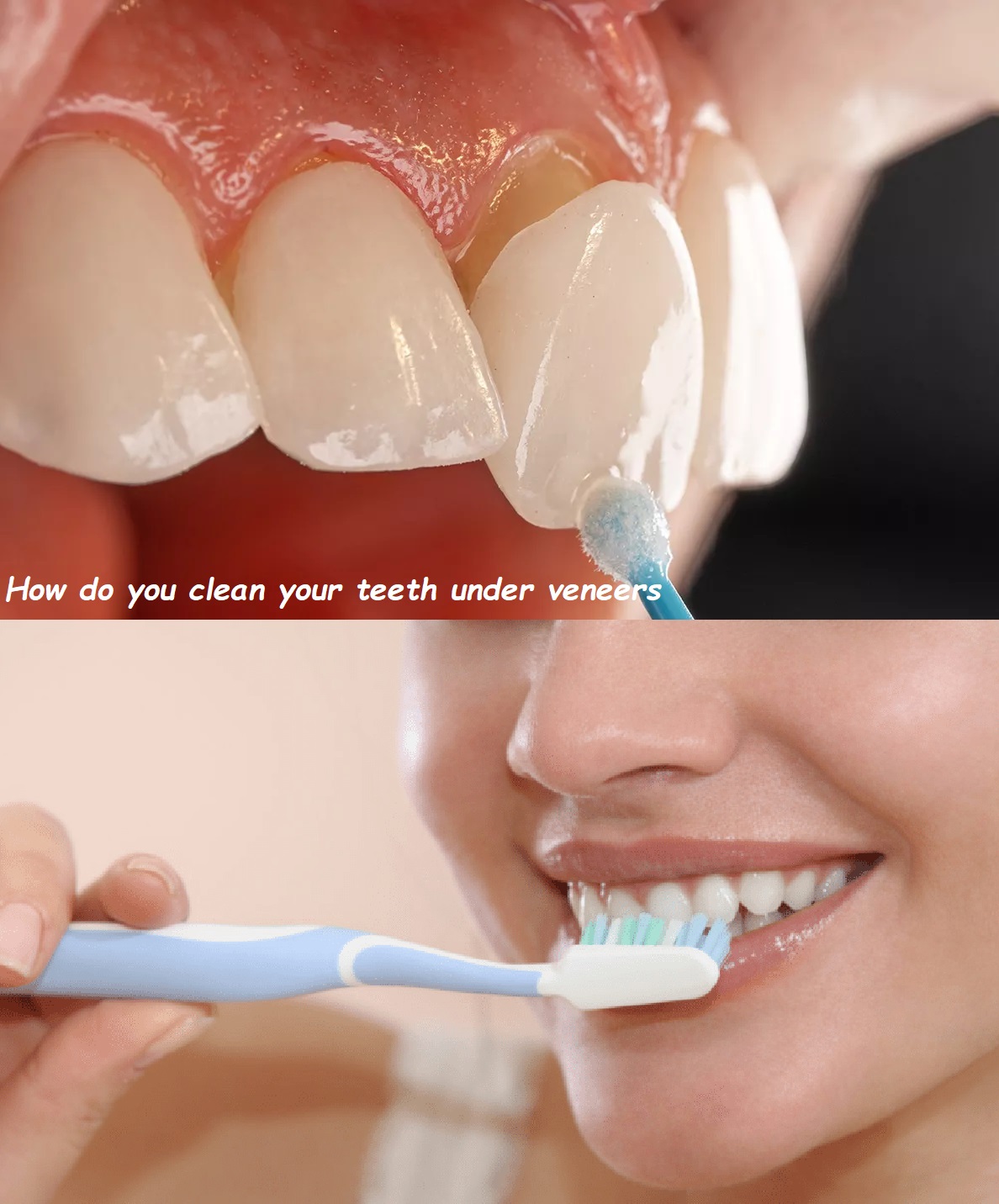 How do you clean your teeth under veneers