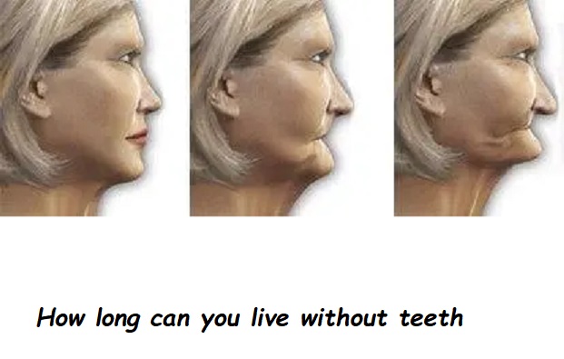 how long can you live without teeth