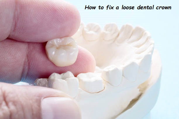 How to fix a loose dental crown