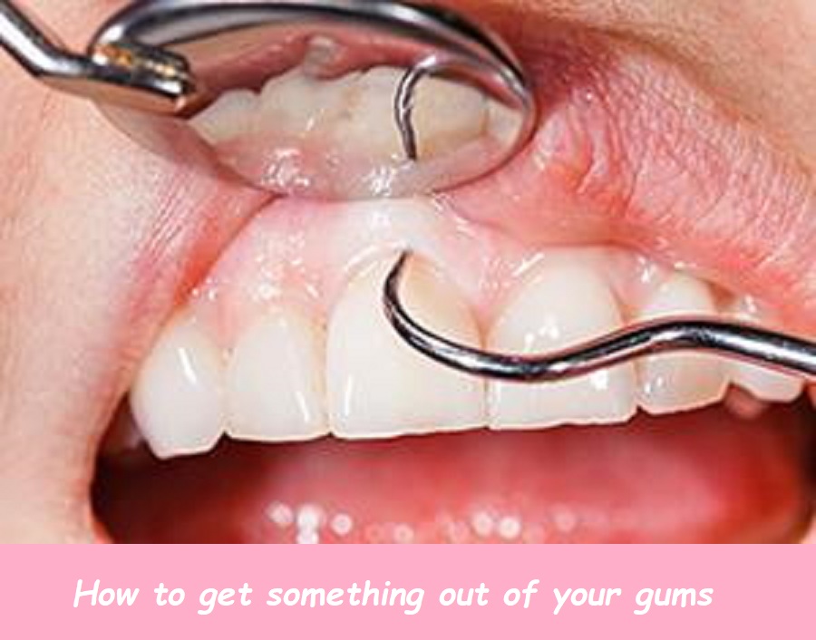 how to get something out of your gums