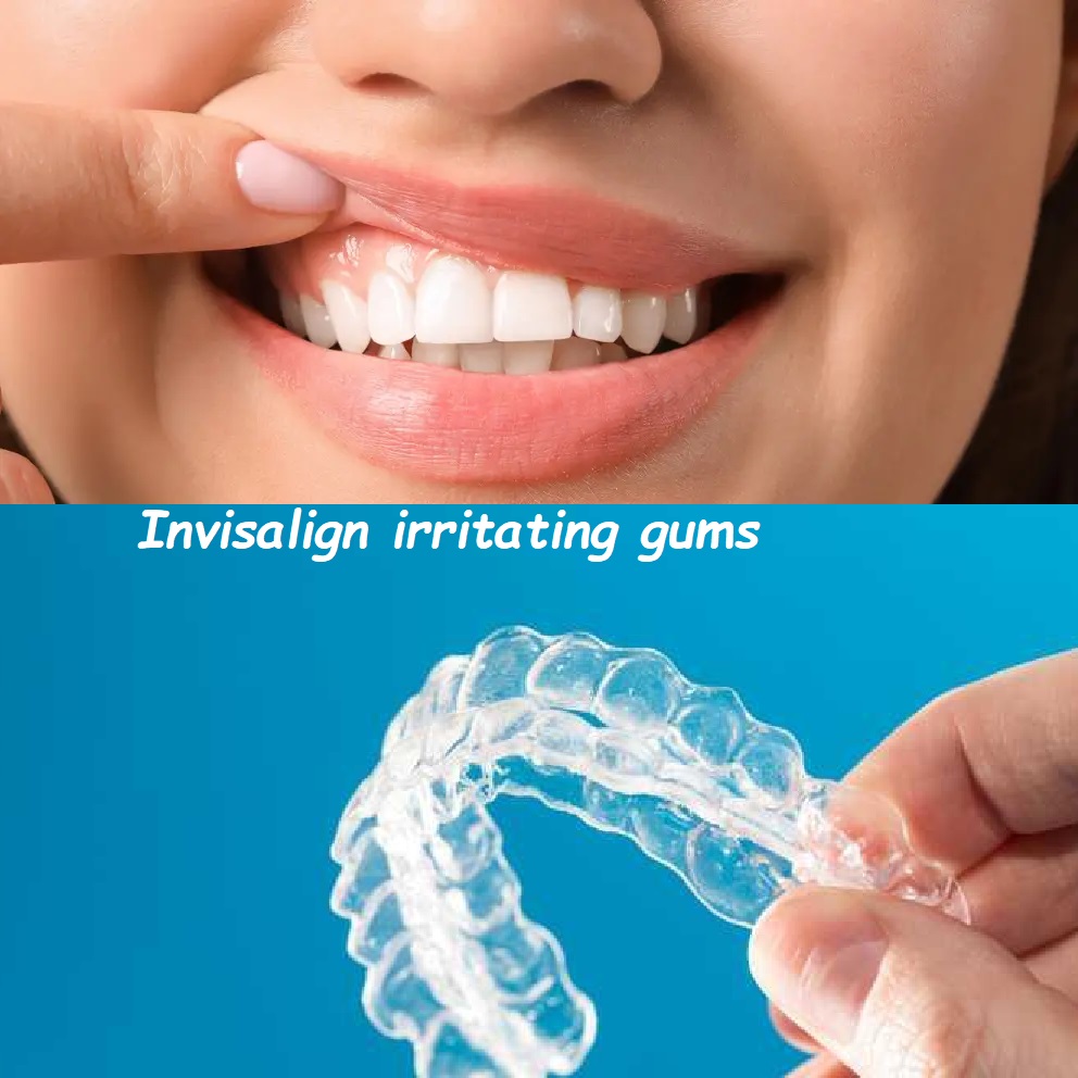 Invisalign irritating gums