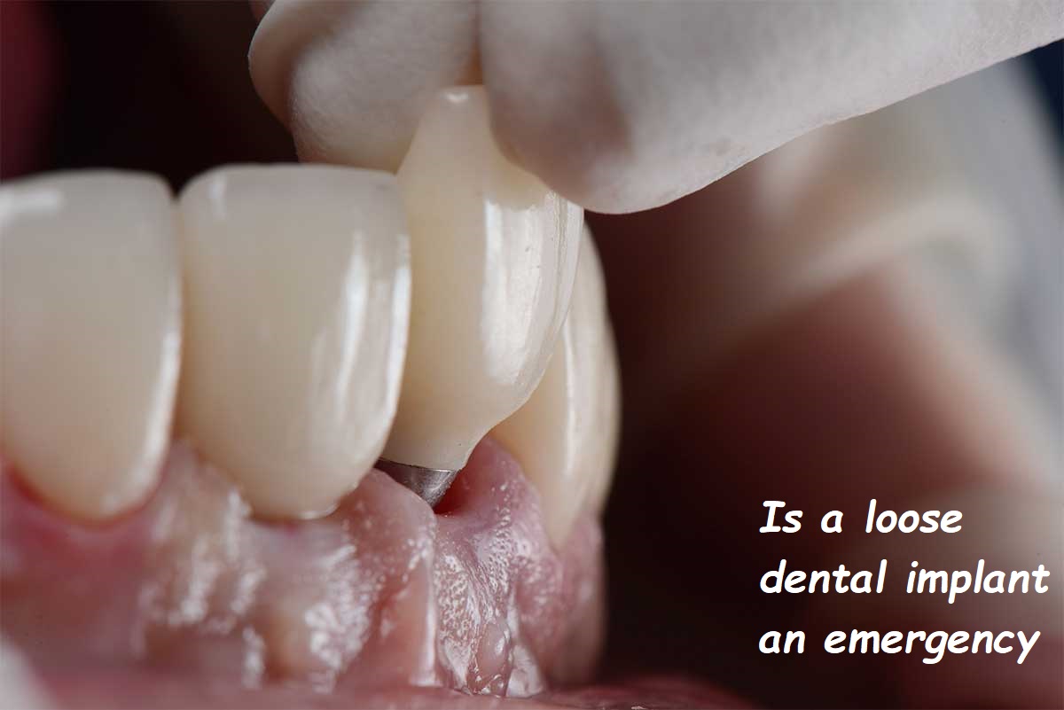 is a loose dental implant an emergency