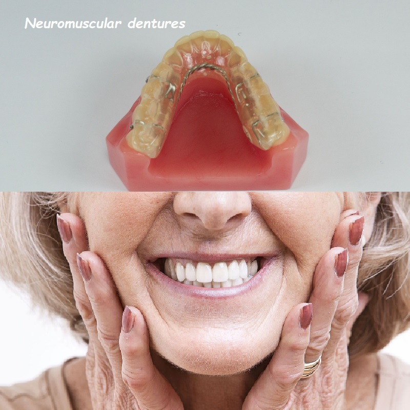 Neuromuscular dentures