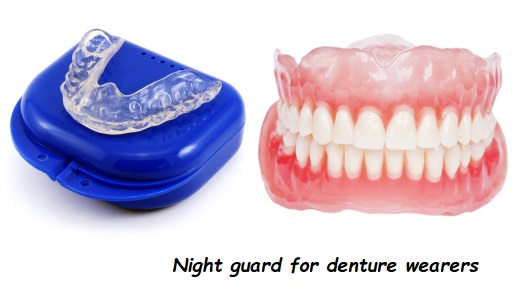 Night guard for denture wearers