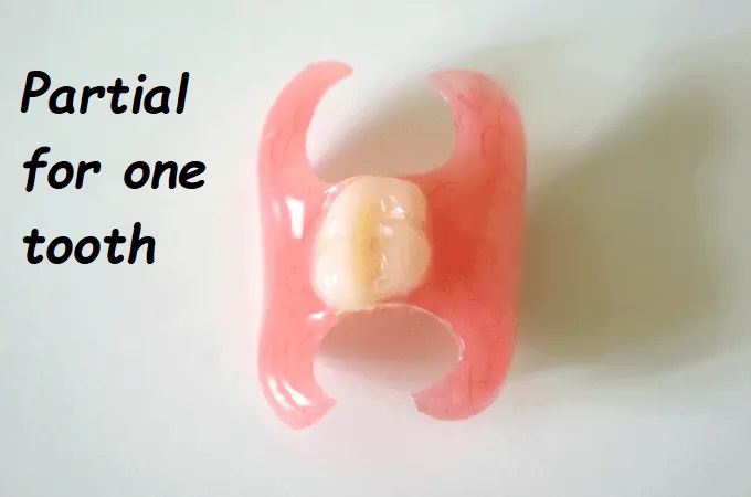 Partial for one tooth