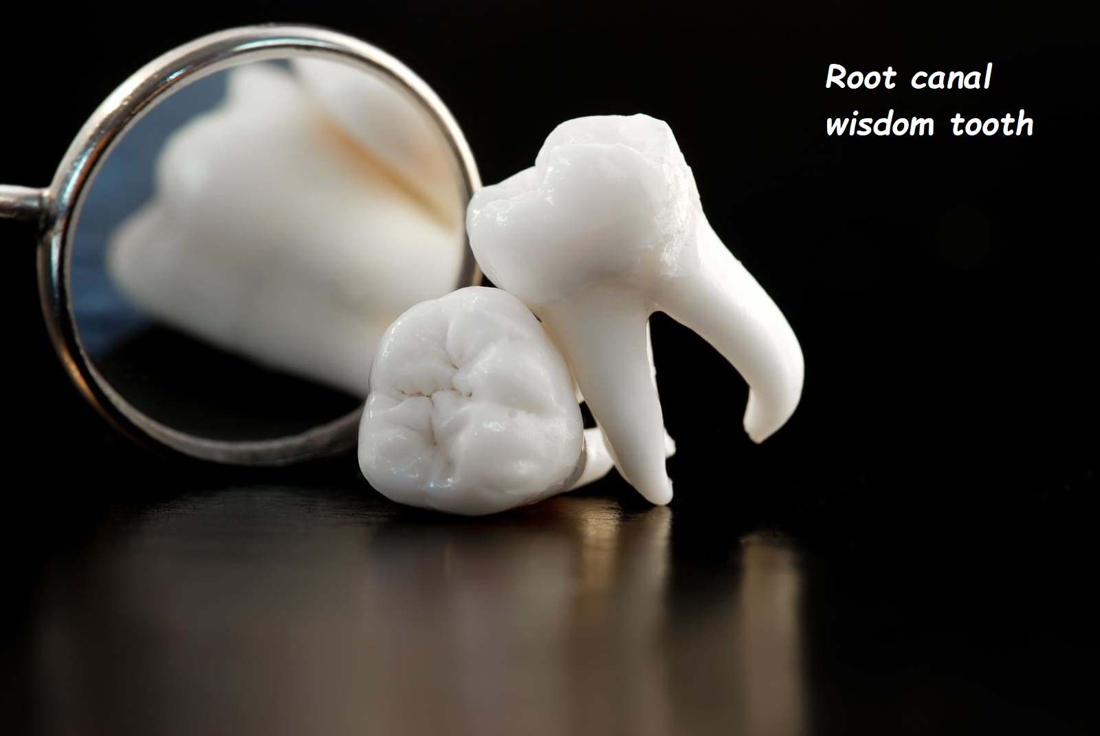 Root canal wisdom tooth