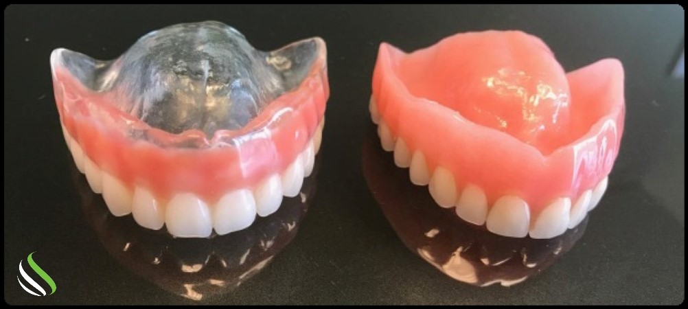 Suction Dentures