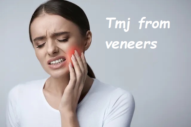 Tmj from veneers