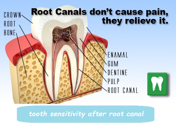 tooth sensitivity after root canal