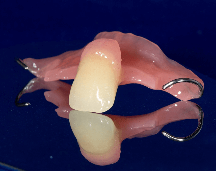 top front front tooth partial dentures