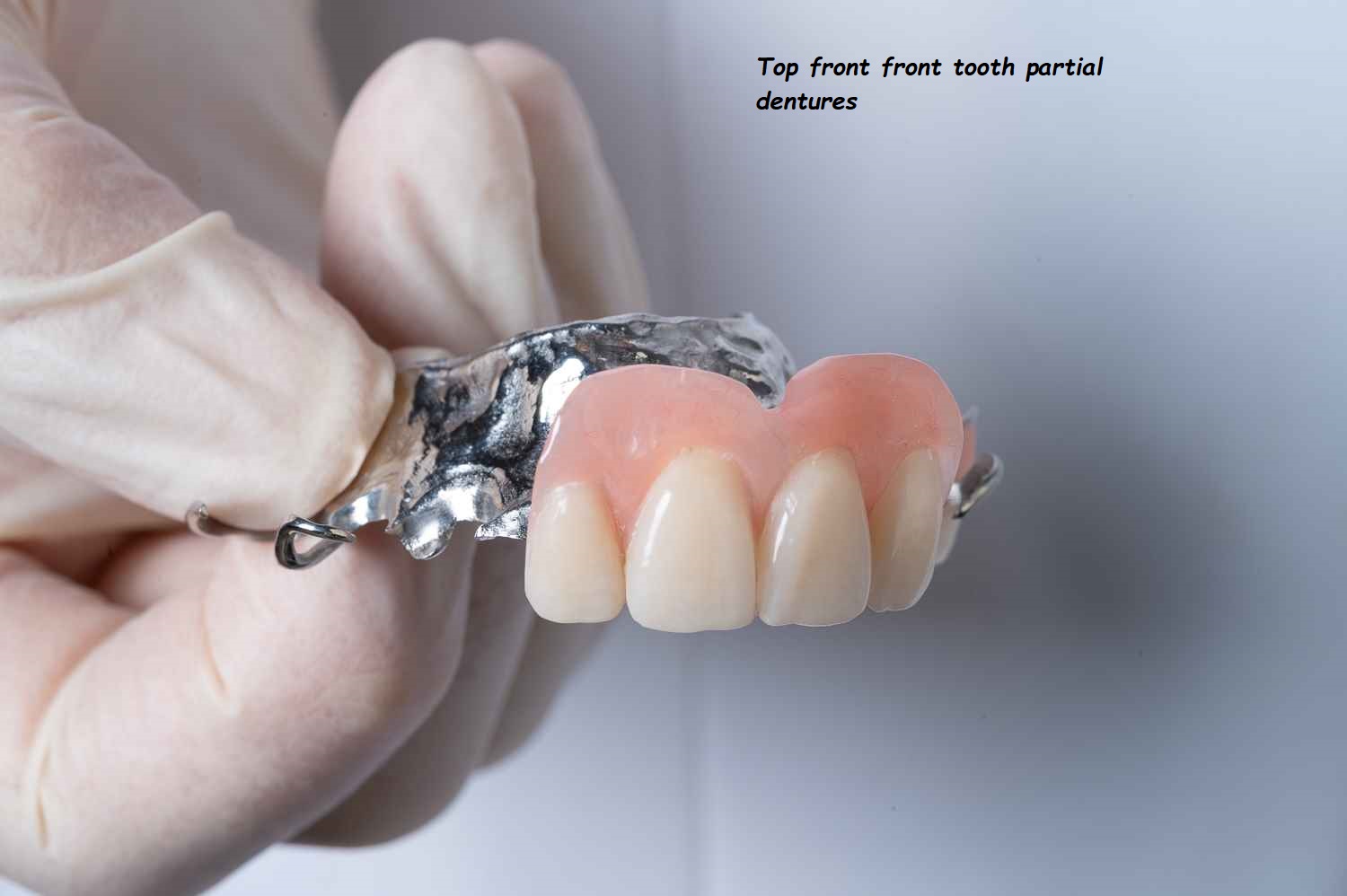 top front front tooth partial dentures