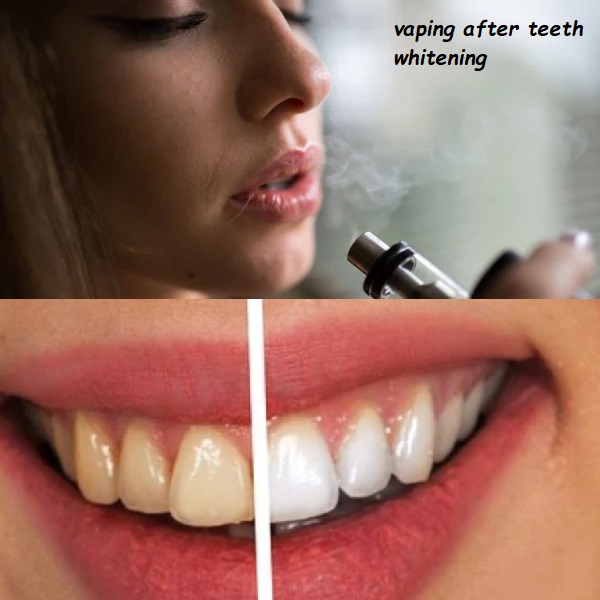 vaping after teeth whitening