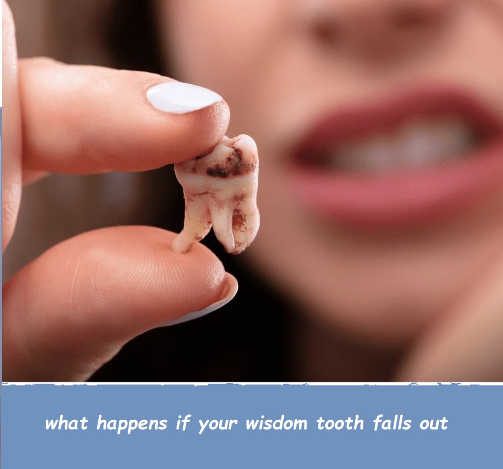 what happens if your wisdom tooth falls out