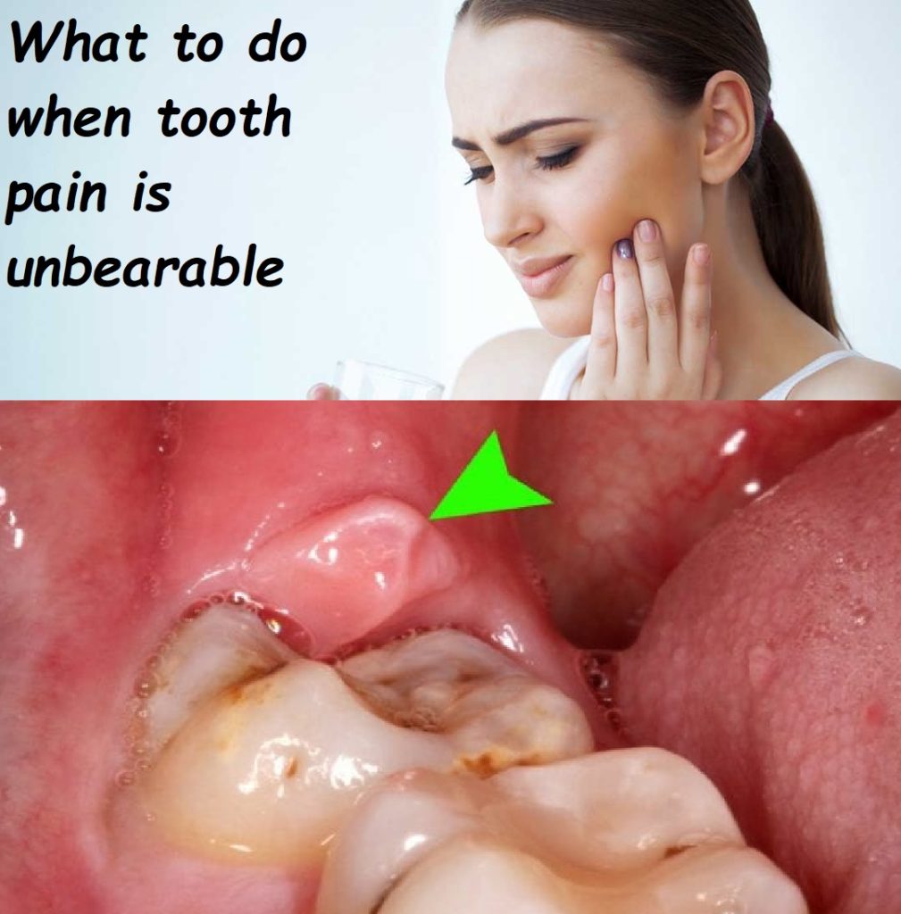 What to do when tooth pain is unbearable