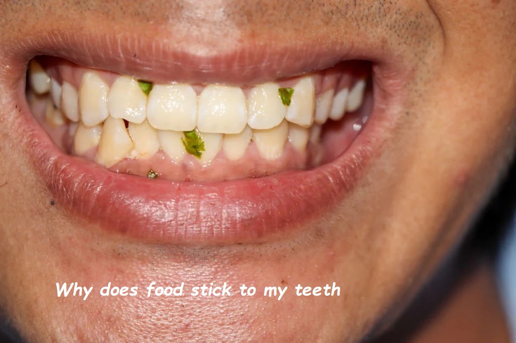 Why does food stick to my teeth