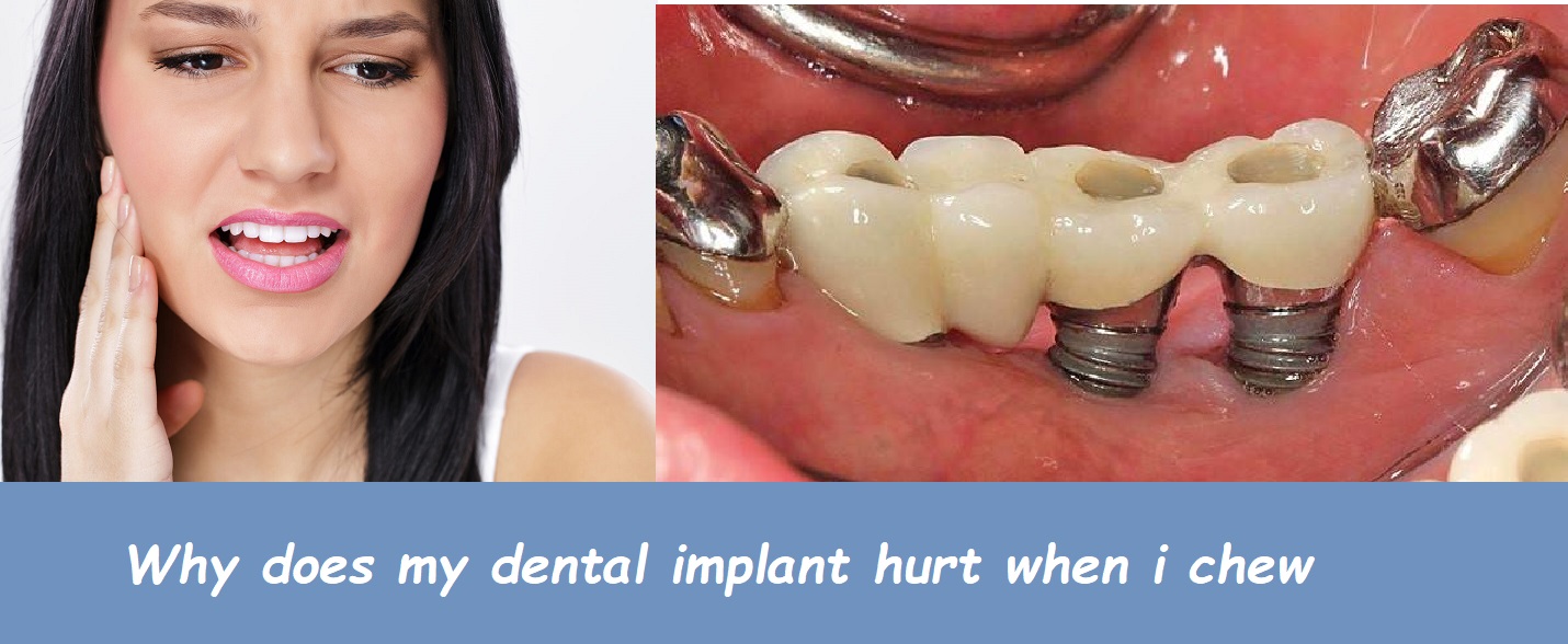 why does my dental implant hurt when i chew