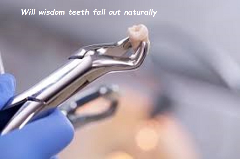 Will wisdom teeth fall out naturally