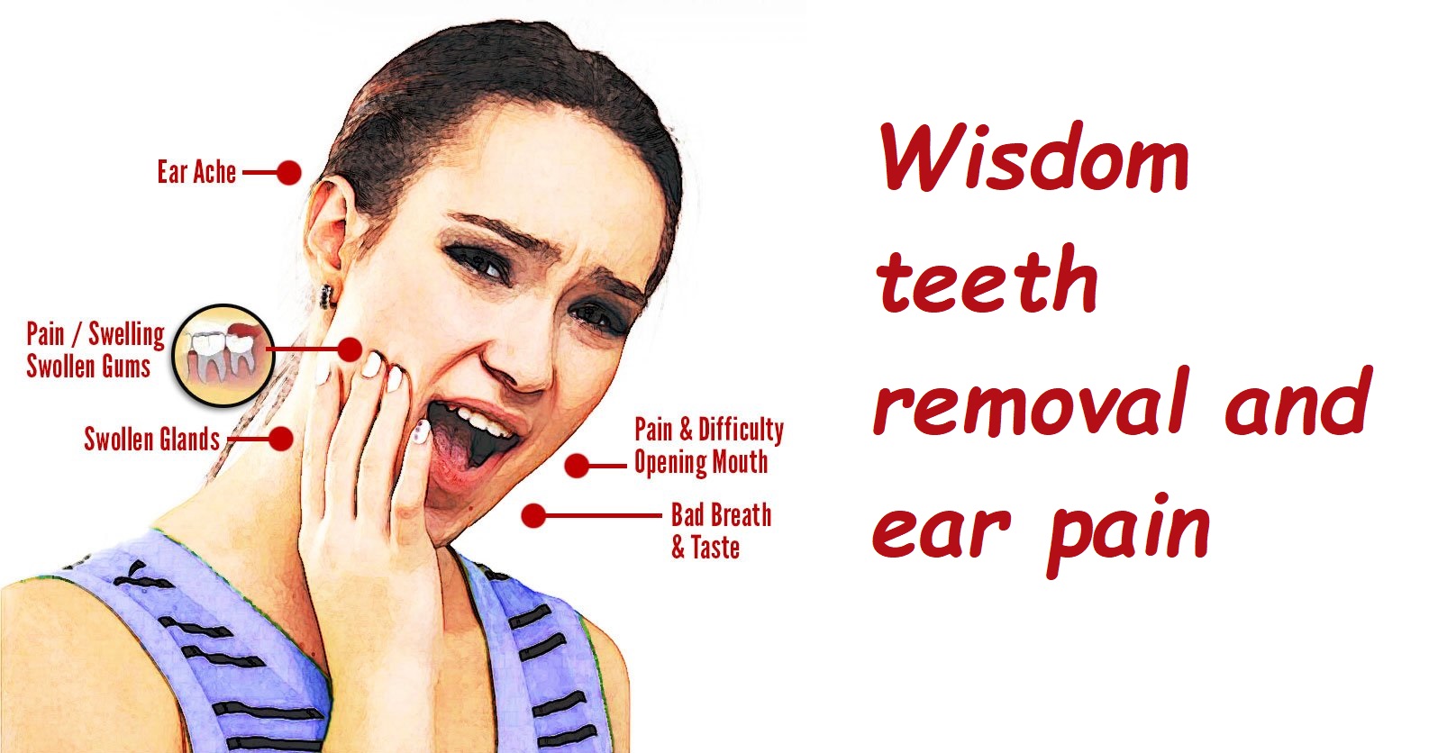 Wisdom teeth removal and ear pain