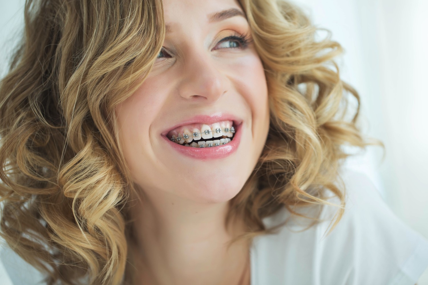 Adult Braces: A Comprehensive Guide to Dental Braces for Adults – Everything You Need to Know