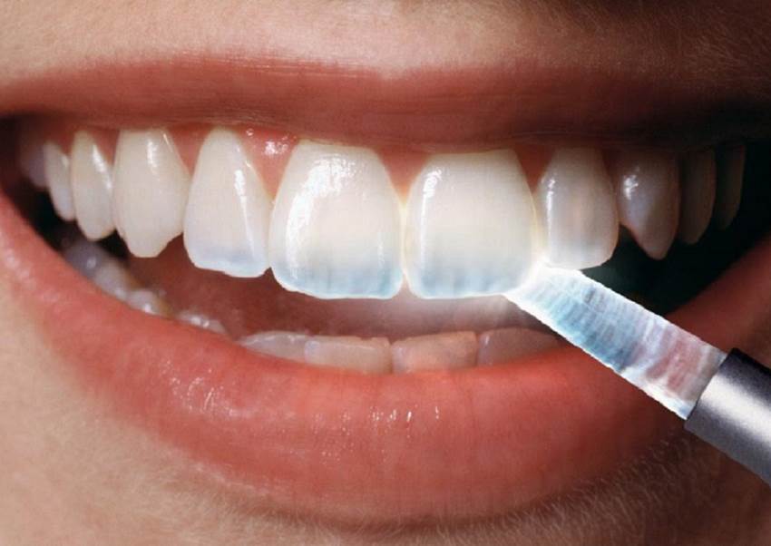 Can Translucent Teeth Be Reversed? Treatment Options Explained