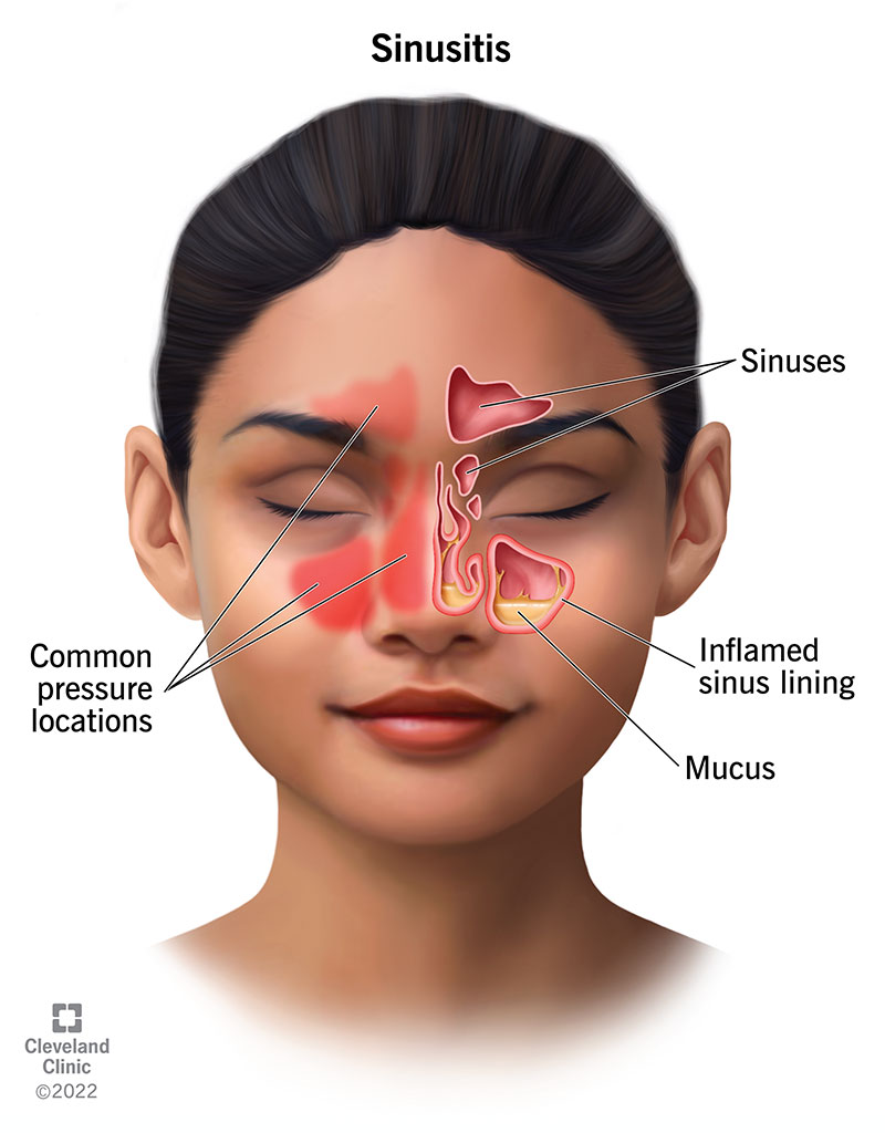 Comprehensive Sinus Health Guide