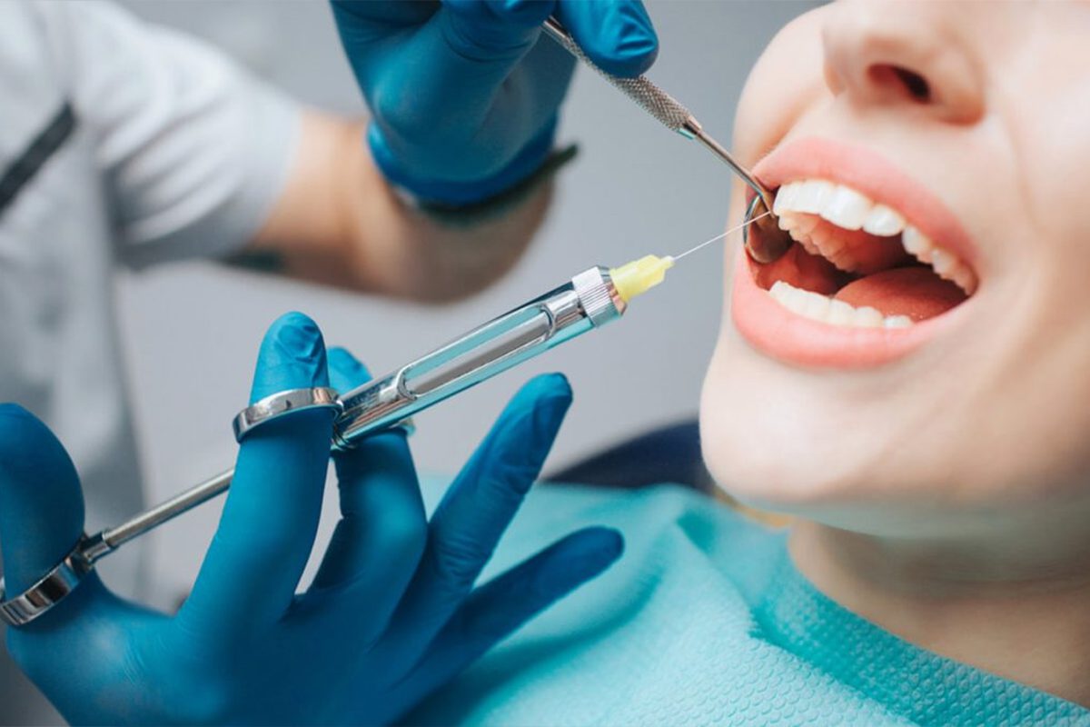 Dental Anesthesia numbing the area before tooth extraction